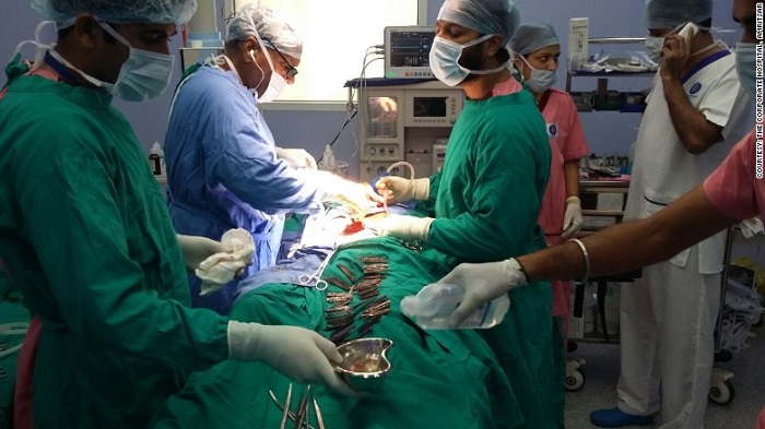 Doctors remove 40 knives from man`s stomach in India